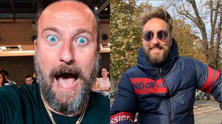 Francesco Facchinetti prima e dopo il trapianto di capelli Foto Meteoweek